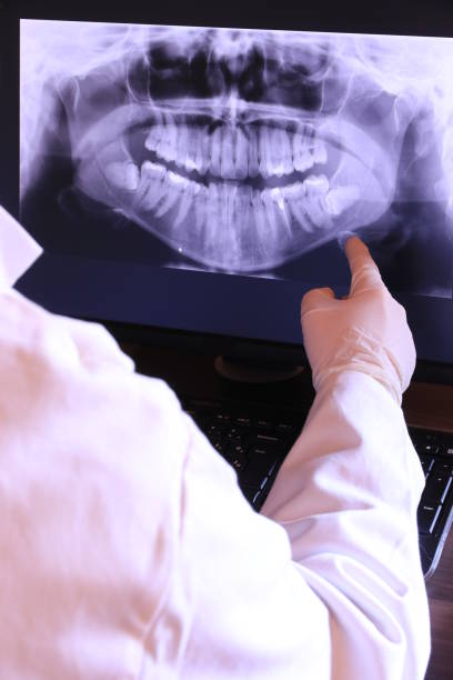 Best Emergency Gum Treatment in Applewood, CO